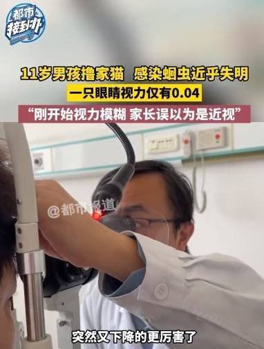 11岁男孩撸猫后视力猛降差点失明,家长误以为是近视,“还好发现得早”!紧急提醒